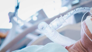 ECMO Treatment Helps To Keep A Person Alive